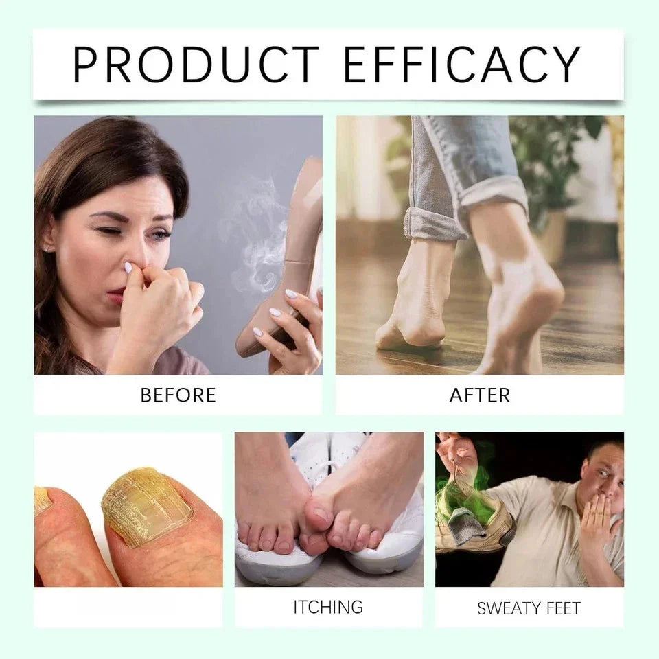 2pcs Ximonth Foot Sanitizer Spray with Tea Tree Oil, Tea Tree Oil Feet Spray,